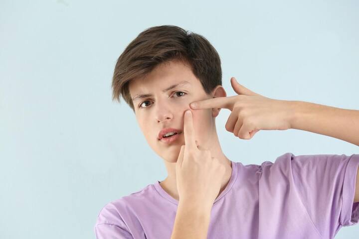 ਤੇਲਯੁਕਤ ਚਮੜੀ ਵਾਲੇ ਲੋਕਾਂ ਨੂੰ ਜ਼ਿਆਦਾਤਰ ਮੁਹਾਸੇ ਹੁੰਦੇ ਹਨ। ਅਜਿਹੀ ਸਥਿਤੀ ਵਿੱਚ, ਤੁਸੀਂ ਘਰ ਵਿੱਚ ਮੌਜੂਦ ਚੀਜ਼ਾਂ ਦਾ ਸੇਵਨ ਕਰਕੇ ਮੁਹਾਸੇ ਦੀ ਸਮੱਸਿਆ ਤੋਂ ਛੁਟਕਾਰਾ ਪਾ ਸਕਦੇ ਹੋ।