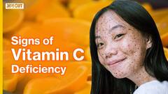 विटामिन सी की कमी से शरीर को क्या नुक्सान होता है?| Uncut