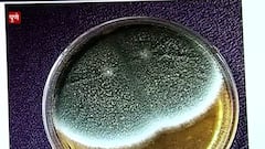 Pune : कोरोनानंतर मणक्याची बुरशी? पुण्यात 5 जणांच्या मणक्याला बुरशी संसर्ग? Special Report