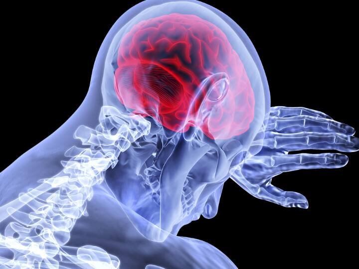 Lifestyle habits that increase your risk of a brain stroke Brain Stroke: ఈ అలవాట్లే... మెదడు స్ట్రోక్‌కు కారణమవుతాయి