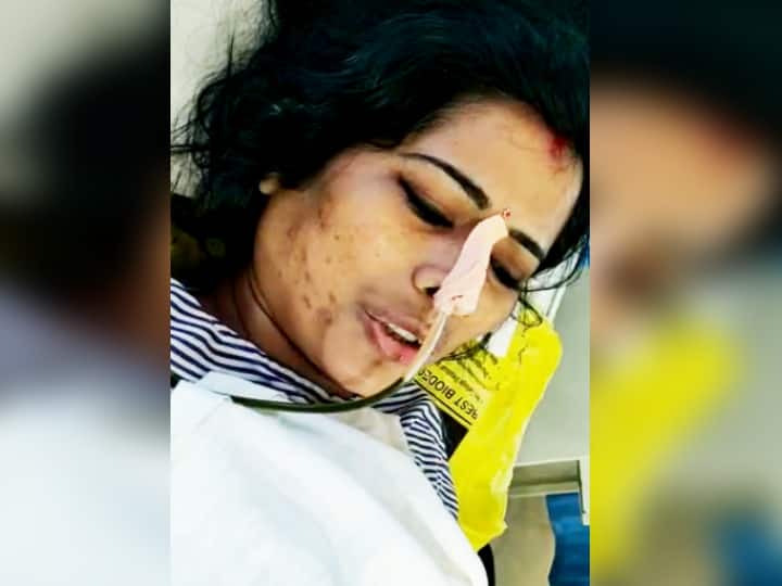 अस्पताल में मोना ने कहा था कि उसने किसी का आजतक कुछ नहीं बिगाड़ा. हाउसवाइफ होने क बाद भी उसका शौक अलग रहा था.