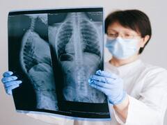 Lung cancer: మీ నడకే మీకు చెప్పేస్తుంది... ఈ మహమ్మారి గురించి