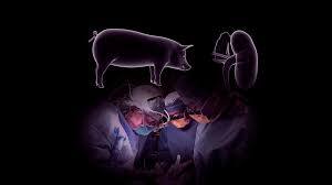 Pig Heart Transplant To Human united states man death after two month of surgery जगात पहिल्यांदाच डुकराचं हृदय लावलेल्या व्यक्तीचं निधन; शस्त्रक्रियेनंतर दोन महिने जगला!