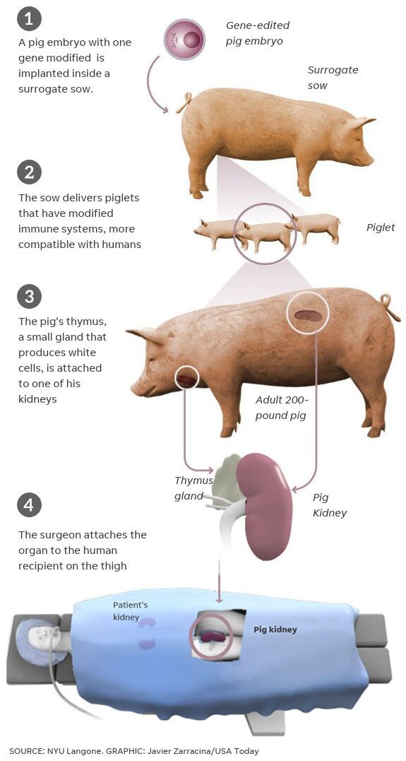 Pig Kidney Transplant: பன்றியின் சிறுநீரகத்தை மனிதருக்குப் பொருத்திய ஆய்வாளர்கள்