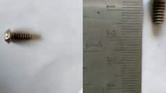 રાજકોટ: 3 વર્ષના બાળકના નાકમાં ફસાયો સ્ક્રૂ, જુઓ શું થયું બાળક સાથે ?