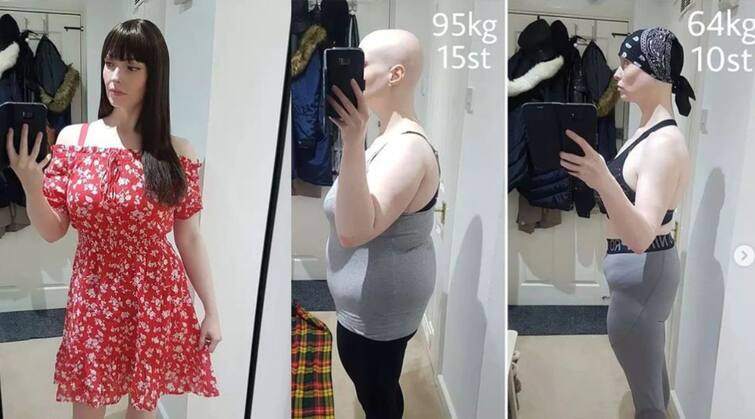 Woman loses 31kg just by deleting Facebook-Instagram, no dieting ਸਿਰਫ ਫੇਸਬੁੱਕ-ਇੰਸਟਾਗ੍ਰਾਮ ਡਿਲੀਟ ਕਰ ਔਰਤ ਨੇ ਘਟਾਇਆ 31 ਕਿਲੋ ਭਰ, ਨਹੀਂ ਕਰਨੀ ਪਈ ਡਾਇਟਿੰਗ 