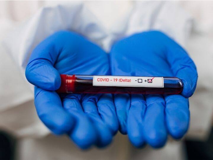 Vaccinated People Can Also Contract And Spread Delta Variant Of Covid-19, Yearlong Study Finds Vaccinated People Can Also Contract And Spread Delta Variant Of Covid-19, Yearlong Study Finds