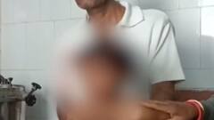 બનાસકાંઠા: રખડતા શ્વાનનો આતંક આવ્યો સામે, 4 વર્ષની બાળકી પર કર્યો હુમલો, જુઓ ગુજરાતી ન્યુઝ