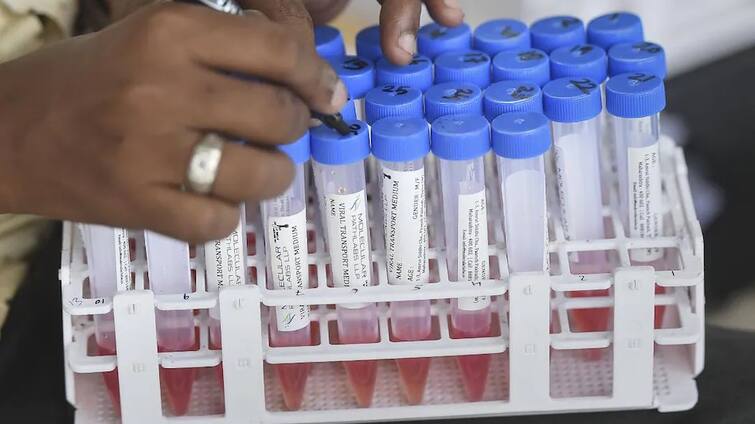 Coronavirus new variant covid delata plus variant ay 4 infectivity rate expert કોરોનાની બંને ડોઝ લીધેલા લોકો AY.4 કોરોના વેરિયન્ટથી સંક્રમિત, આ મુદ્દે જાણો શું કહે છે એક્સપર્ટ