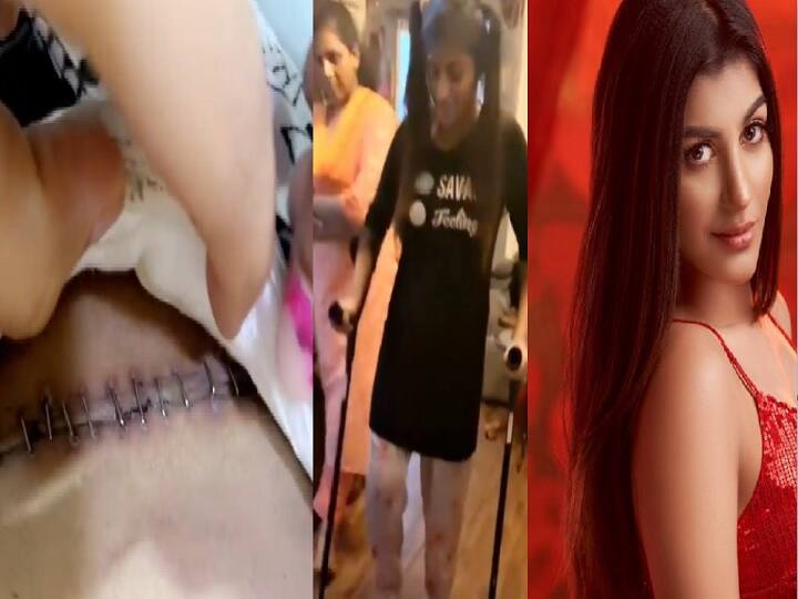 Actress yashika anand shares about her health status on Instagram reels Watch Video | உடலில் போடப்பட்ட தையல்கள்.. நான் மீள்கிறேன்.. ரீல்ஸ் பதிவிட்ட யாஷிகா ஆனந்த்!
