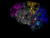 Brain Stroke: ఈ అయిదు పనులు చేయకపోతే బ్రెయిన్ స్ట్రోక్ వచ్చే అవకాశం... ముందుజాగ్రత్తపడమంటున్న వైద్యులు