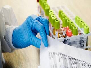 Diabetes and A1C | குடும்பத்தில் சர்க்கரை நோயாளிகளா? அவசிய தேவையாகும் A1C டெஸ்ட்! முழு விவரம்!