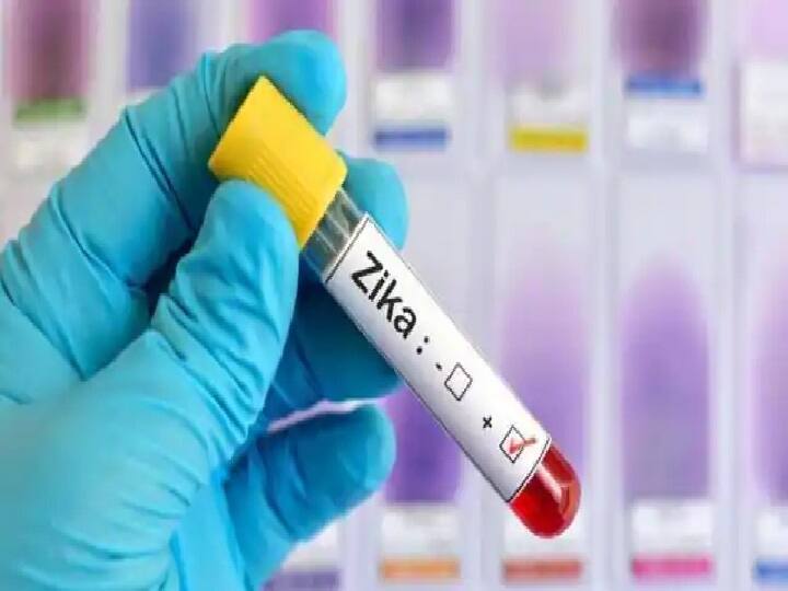 Kannauj Health department alerted after the first case of Zika virus ...