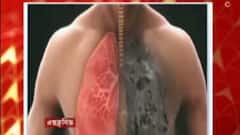 Silicosis: সহজ হবে সিলিকোসিস রোগ নির্ণয়ের পদ্ধতি, শীঘ্রই বাজারে আসছে কিট | Bangla News