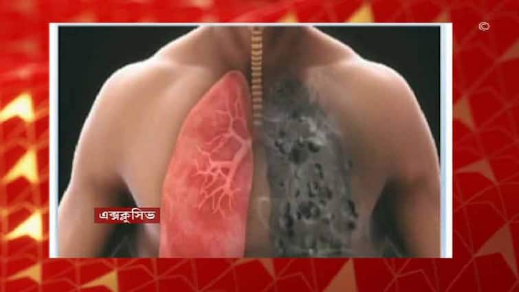 Kolkata: Silicosis, a difficult disease of the lungs, will be detected in the test, the kit was discovered by a Bengali researcher Silicosis: ফুসফুসের কঠিন রোগ সিলিকোসিস ধরা পড়বে পরীক্ষাতেই, কিট আবিষ্কার বাঙালি গবেষকের