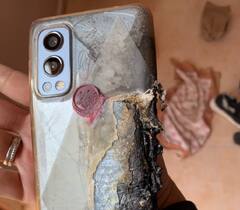 OnePlus: பாக்கெட்டில் வைத்த ஃபோன் வெடித்த பரிதாபம் - ஒன் ப்ள்ஸ் கஸ்டமர்கள் உஷார்!