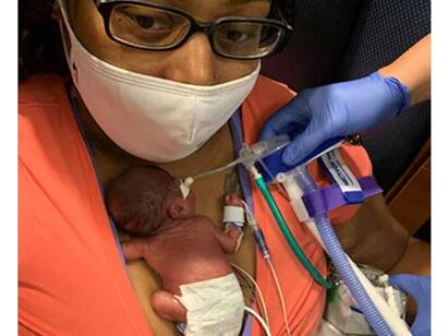 Worlds most premature baby defies sub-1% survival odds to break record ஐந்து மாதத்தில் பிறந்த குழந்தை: அங்கீகரித்த கின்னஸ் நிறுவனம்!