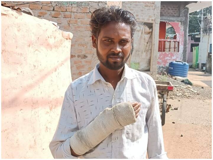 Madhya Pradesh: X-ray machine malfunctions in Sehore hospital, patients getting upset ann MP News: शिवराज सरकार में बदइंतजामी! अस्पतालों में एक्स-रे फिल्म की कमी, इलाज के लिए परेशान हो रहे मरीज