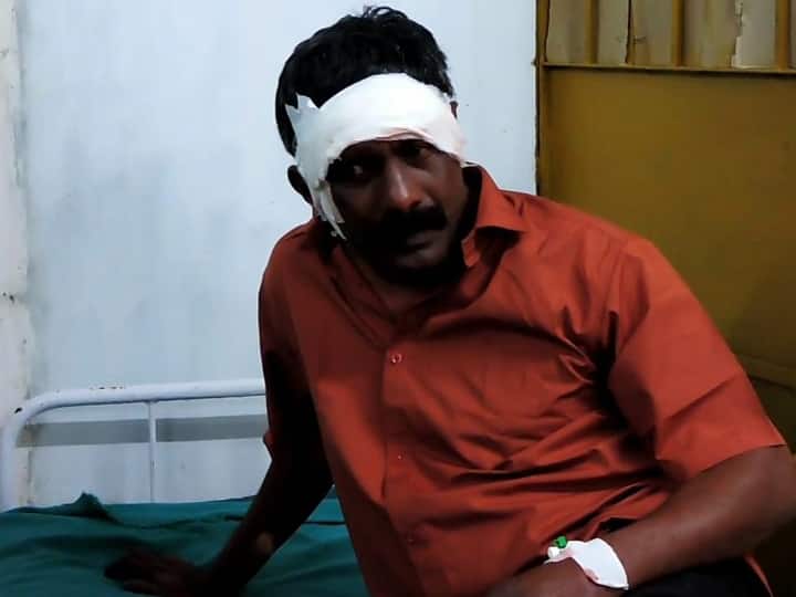 Couple arrested for stabbing policemen in Kodaikanal மாஸ்க் போடச் சொன்ன போலீஸ்... அட்ரஸ் கொடுத்து வீட்டுக்கு வரவைத்து கத்தியில் குத்திய தம்பதி கைது!