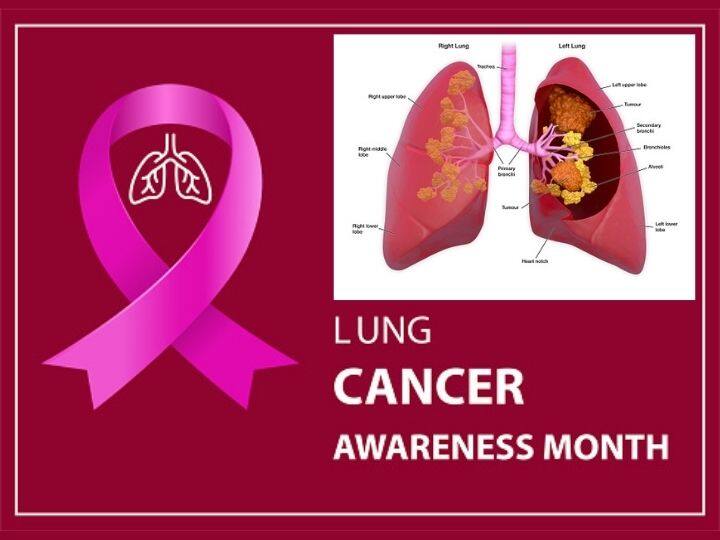 Lung Cancer Awareness Month: Smoking Not The Only Culprit, Protect Your Lungs From Air Pollution Too