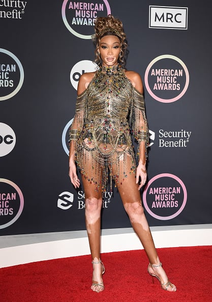 Winnie Harlow attends the 2021 American Music Awards at Microsoft Theater on November 21, 2021 in Los Angeles, California. (Photo by Axelle/Bauer-Griffin/FilmMagic)