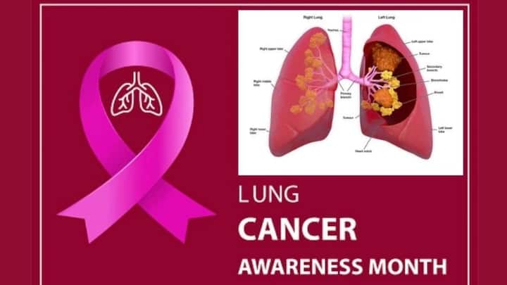 Lung Cancer Awareness Month: How air pollution affects our health, know in details Lung Cancer Awareness Month: বায়ু দূষণ কীভাবে ক্যানসারের মতো মারণ রোগের ঝুঁকি বাড়ায়?