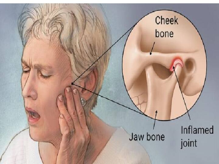 Jaw Pain and Heart Attack | தாடை வலி, மாரடைப்பு வருவதற்கான அறிகுறியா?