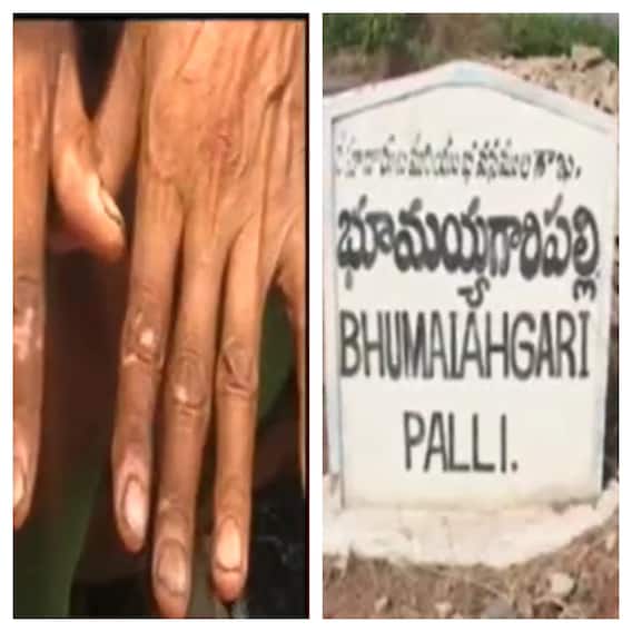 Uranium :యురేనియం ప్రాజెక్టులో బ్లాస్టింగ్ వల్ల తుమ్మల పల్లి గ్రామంలో ఇళ్లు బీటలు