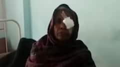 Muzaffarpur अस्पताल में 25 से ज्यादा लोगों की ऑपरेशन के बाद आंखें खराब