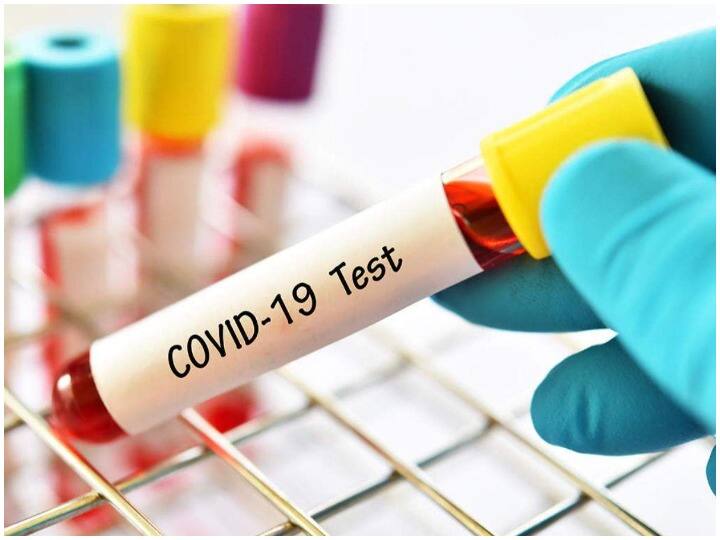 Coronavirus 5 people found positive in Jaipur suspected Omicron relatives had returned from South Africa Corona case in Jaipur: जयपुर में एक ही परिवार के पांच लोग कोरोना संक्रमित, साउथ अफ्रीका से लौटे थे रिश्तेदार