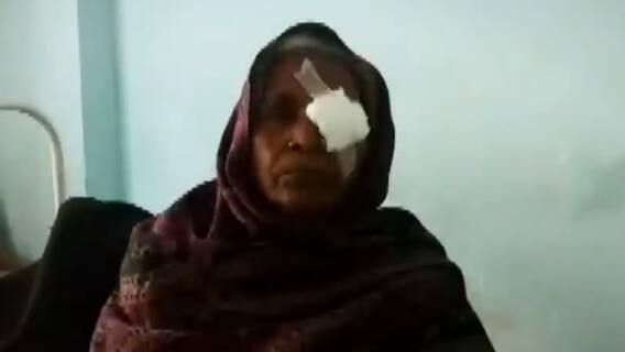 Muzaffarpur Cataract Operation: आंखों की रोशनी खोने वाले पीड़ितों ने सुनाई आपबीती, हुआ क्या था ?