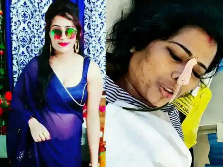 Model Mona Rai Murder: Shooter Vishwakarma surrenders in court, Sharda went 'underground' after killing her husband's lover ann Mona Rai Murder: बिहार की एक मॉडल जिसपर फिदा था पटना का बिल्डर, अब कोर्ट में शूटर खोलेगा ‘आशिकी’ की कहानी
