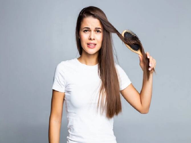 Dandruff Remedy During Winter Use Castor Oil To Get Rid Of Dandruff In Winters | Hair Care Tips: Dandruff In Cold Weather Disturbs, Castor Oil Take Care Of Hair Dandruff Remedy During Winter Use Castor Oil To Get Rid Of Dandruff In Winters | Hair Care Tips: Dandruff In Cold Weather Disturbs, Castor Oil Take Care Of Hair