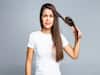 Hair Care Tips: Facing Dandruff Problem In Winters? Use Castor Oil For Hair Care