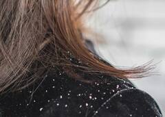 Hair Care Tips: ਠੰਢੇ ਮੌਸਮ 'ਚ ਸਿੱਕਰੀ ਦੀ ਪ੍ਰੇਸ਼ਾਨੀ ਤੋਂ ਇੰਝ ਬਚੋ
