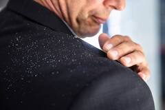 Hair Care Tips: শীতকালে খুশকির সমস্যা মেটান এই সহজ উপায়ে