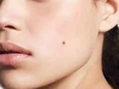 Mole On Face: शरीर के इन अंगों पर तिल का होना लव लाइफ के बारे में देता है कुछ संकेत, जानें