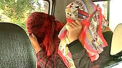 Fake Hair Transplant : बोगस हेअर ट्रान्सप्लांट रॅकेटचा पर्दाफाश, 3 वर्षात 300 जणांना फसवलं