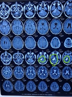 Deucha Pachami: দেউচা পাচামিতে প্রস্তাবিত কয়লা খনি এলাকা পরিদর্শনে গিয়ে বিক্ষোভের মুখে সুজন-রামচন্দ্র| Bangla News