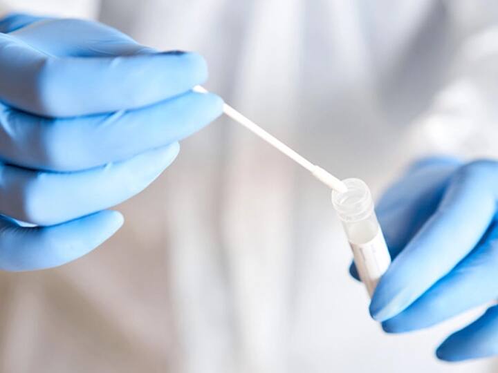 Jabalpur district private pathology lab  Corona RTPCR  Rapid Antigen test ban due to negligence of Corona ANN Jabalpur News: जबलपुर में अब प्राइवेट लैब में नहीं होगा कोरोना टेस्ट, जानें क्यों