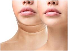 Health Tip: Double Chin से बिगड़ रही है चेहरे की सुंदरता? छुटकारा पाने के लिए करें ये योग