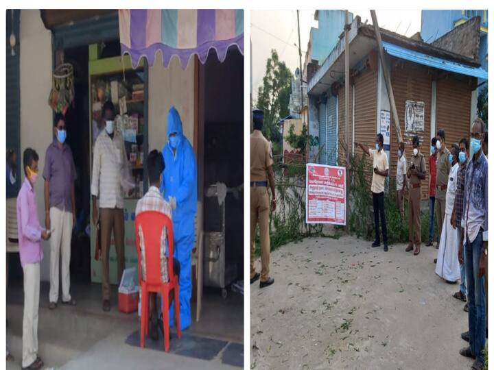 ஒமிக்ரான் அறிகுறி கண்டறியப்பட்ட பெண்ணின் தந்தைக்கு கொரோனா தொற்று பாதிப்பு Corona infection infects father of woman diagnosed with omega-3s near Arani ஒமிக்ரான் அறிகுறி கண்டறியப்பட்ட பெண்ணின் தந்தைக்கு கொரோனா தொற்று பாதிப்பு