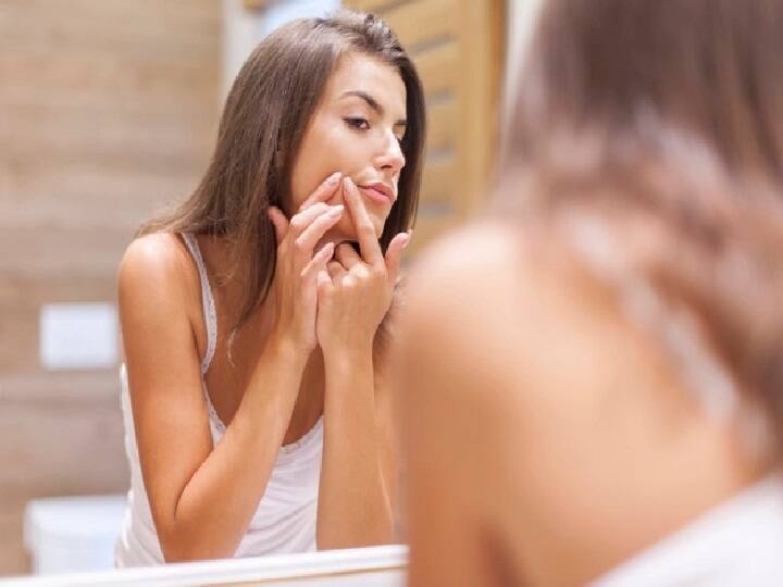 Skin Care Tips Follow these Home Remedies to get rid of Open Pores Skin Care Tips: पिंपल्स और एक्ने के कारण स्किन पर पड़ गए हैं गड्ढे, इन घरेलू नुस्खों को करें ट्राई