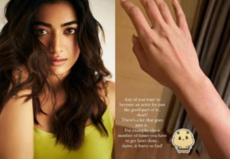 Actress Rashmika Mandanna posts a picture of her arm after laser treatment in Instagram Rashmika Mandanna | `சினிமாவுல நடிக்கணும்னு ஆசையா? இதை யோசிச்சுக்கோங்க..  எச்சரிக்கும் ராஷ்மிகா மந்தனா...