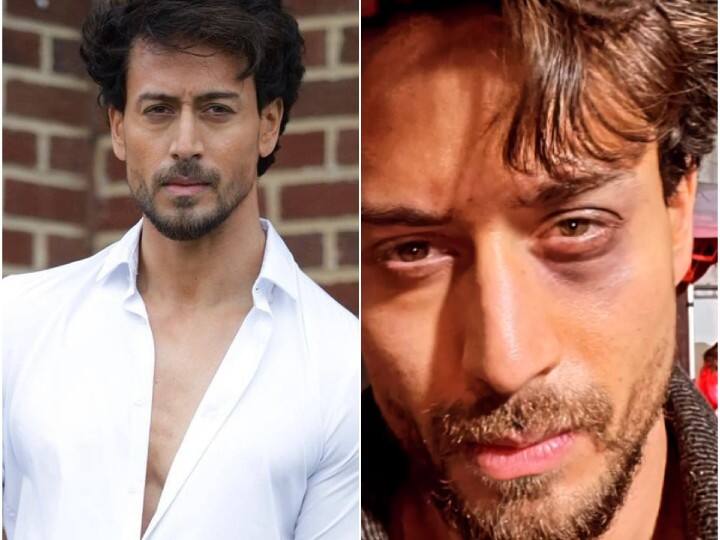 Tiger Shroff Injures His Eye While Shooting Kriti Sanon Starrer 'Ganapath: Part 1', See PIC Tiger Shroff Injures His Eye While Shooting Kriti Sanon Starrer 'Ganapath: Part 1', See PIC Tiger Shroff Injures His Eye While Shooting Kriti Sanon Starrer 'Ganapath: Part 1', See PIC