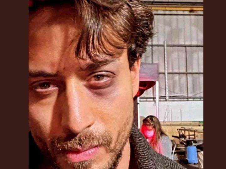 Tiger Shroff Accident: Ganapath की शूटिंग के दौरान टाइगर श्रॉफ की आंख में लगी चोट, सेल्फी शेयर कर एक्टर ने लिखी ये बात