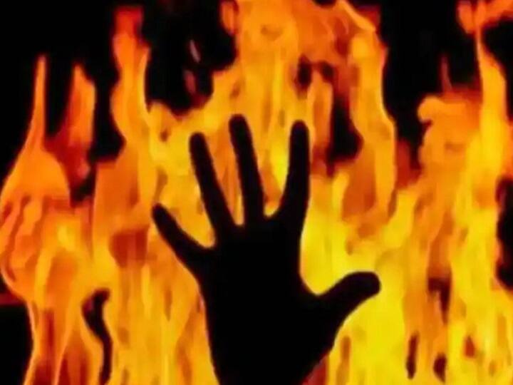Noida news: 2 children die due to scorched in Noida, 1 admitted in safdarjung hospital in critical condition ann Noida News: नोएडा में आग की लपटों ने दो परिवार में कर दिया अंधेरा, 2 मासूमों की झुलसने से हुई मौत, 1 की हालत गंभीर