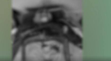 CRPF Firing : ములుగు జిల్లా వెంకటాపురం పోలీస్ స్టేషన్ లో ఫైరింగ్...ఒకరు మృతి