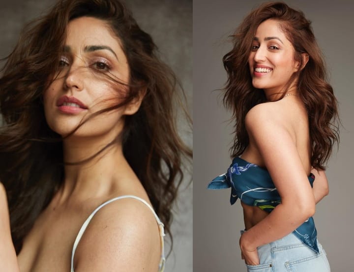 Yami Gautam On Skin Problem: यामी गौतम को है ये बीमारी, छिपाने के लिए सेट पर होती थीं ऐसी बातें Yami Gautam is battling with Incurable Skin Problem, keratosis pilaris disease Yami Gautam On Skin Problem: यामी गौतम को है ये बीमारी, छिपाने के लिए सेट पर होती थीं ऐसी बातें