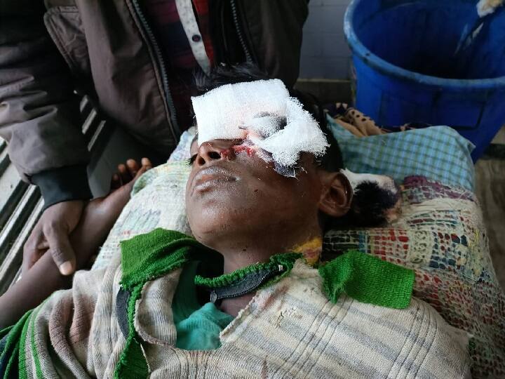 Jharkhand Mistaking the ball the child picked up the bomb in Sahebganj, know what happend next ann   Jharkhand: गेंद समझकर बच्चे ने उठा लिया बम, जोरदार धमाके के साथ हुआ विस्फेट...मचा हड़कंप